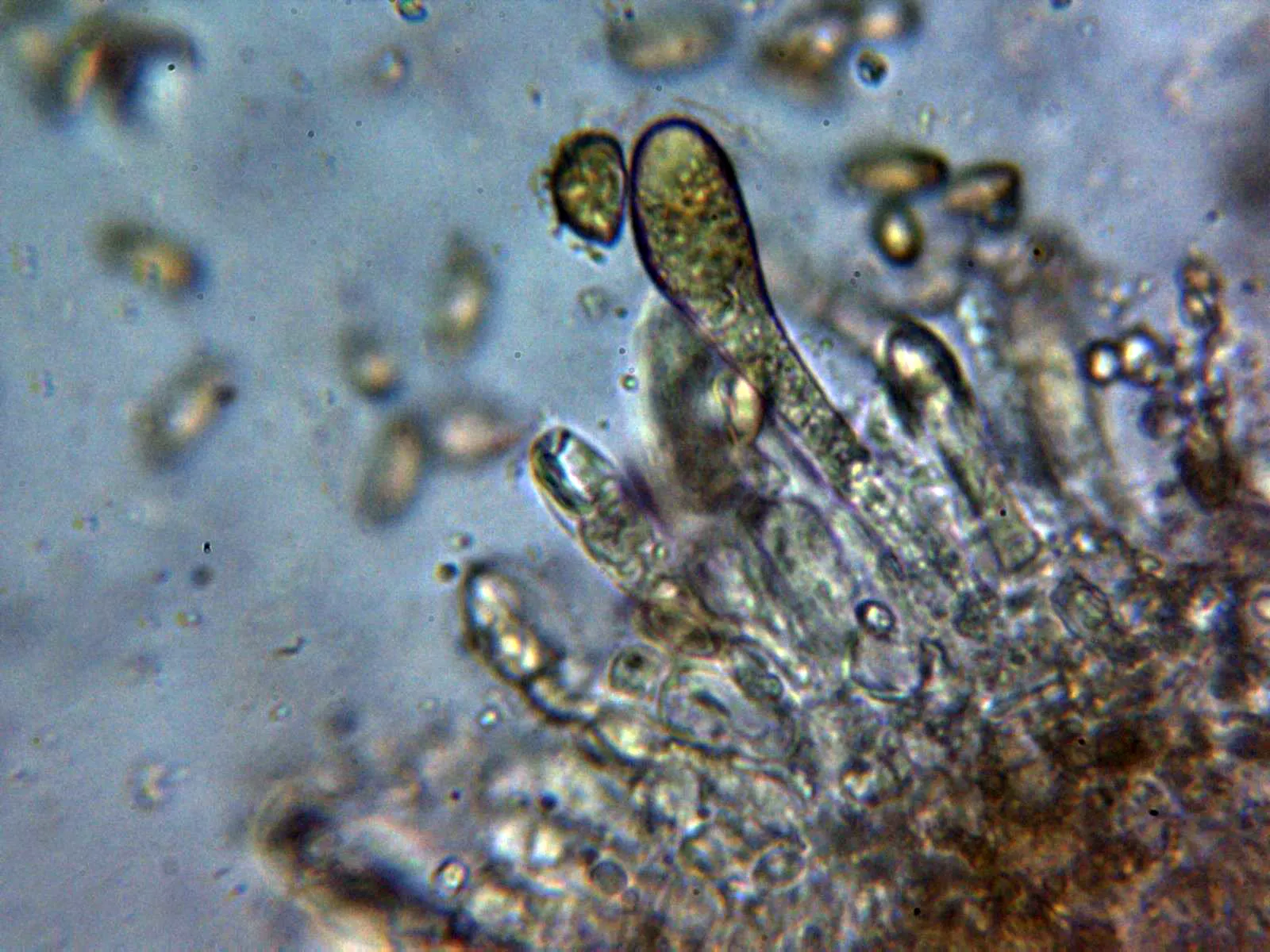 Microscopía de Suillus collinitus - 10 - Cistidio 2